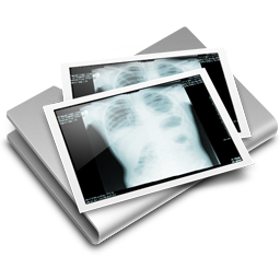 Thorax X Ray