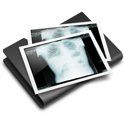 Thorax X Ray Black