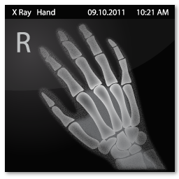 X Ray Hand